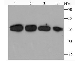 TXNIP Antibody (JM60-35), Novus Biologicals 100 &mu;l; Unconjugated:Antibodies,